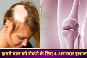 Hair Faal Kaise Roke:बॉडी में कम हुआ ये विटामिन तो झड़ जाते हैं बाल, हड्डियों का बनने लगता है चूरमा, तुरंत खाना शुरू कर दें ये चीजें